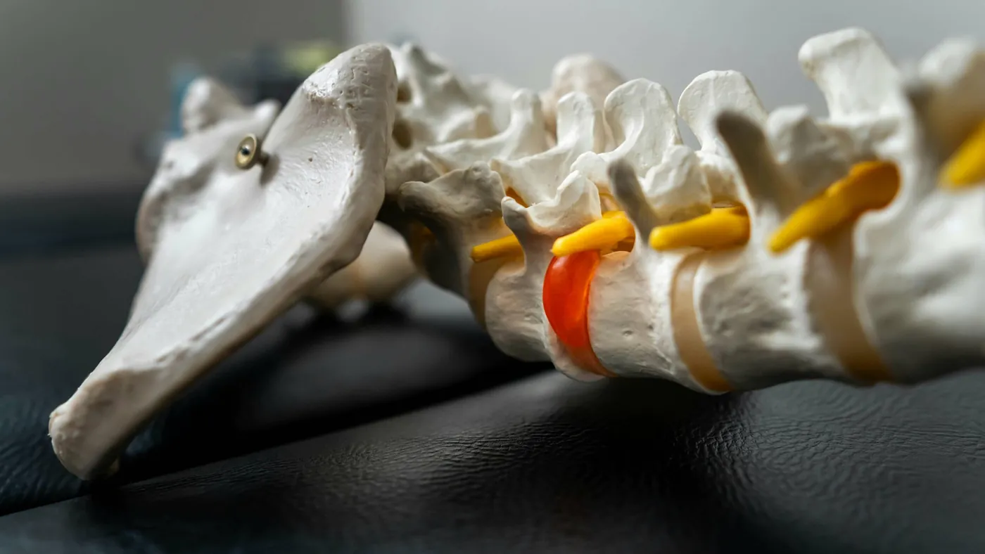 Modello anatomico della colonna lombare e del sacro con i dischi intervertebrali